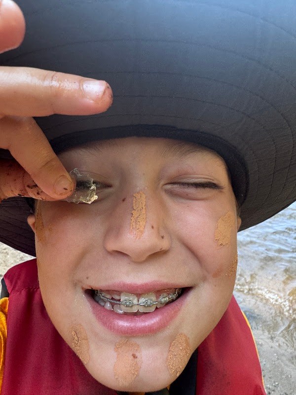 Child with braces smiling, holding a small rock near eye, wearing a hat.